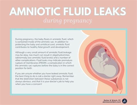 amniotic.fluid leaking|Leaking amniotic fluid: Signs and what to do